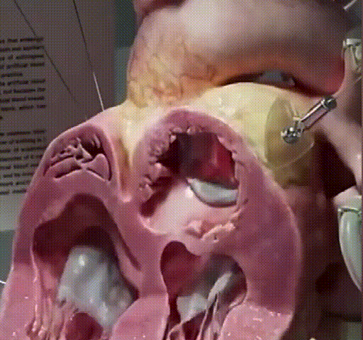 13.gif